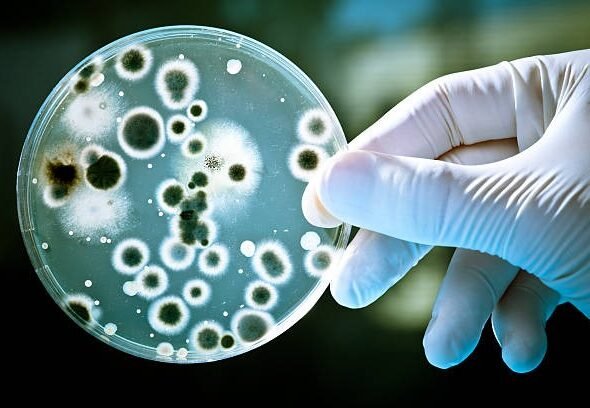 MSc Medical Microbiology